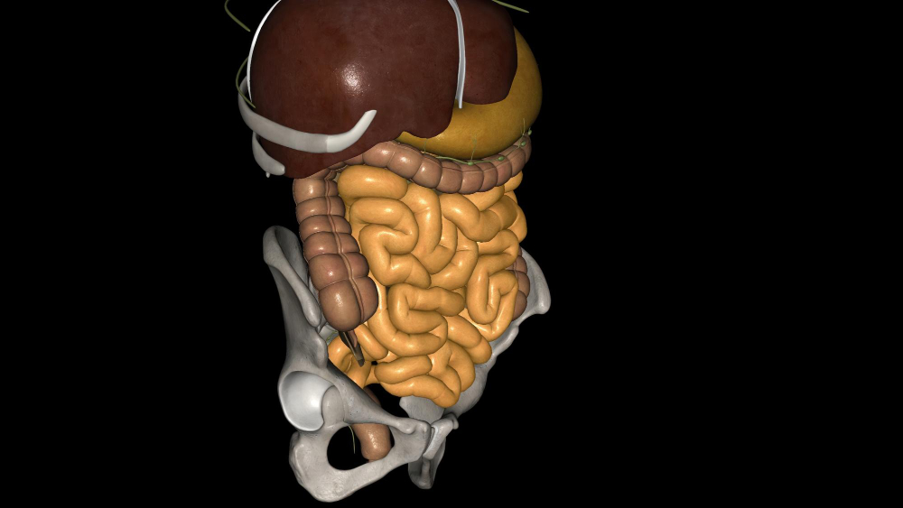 Bowel Obstruction