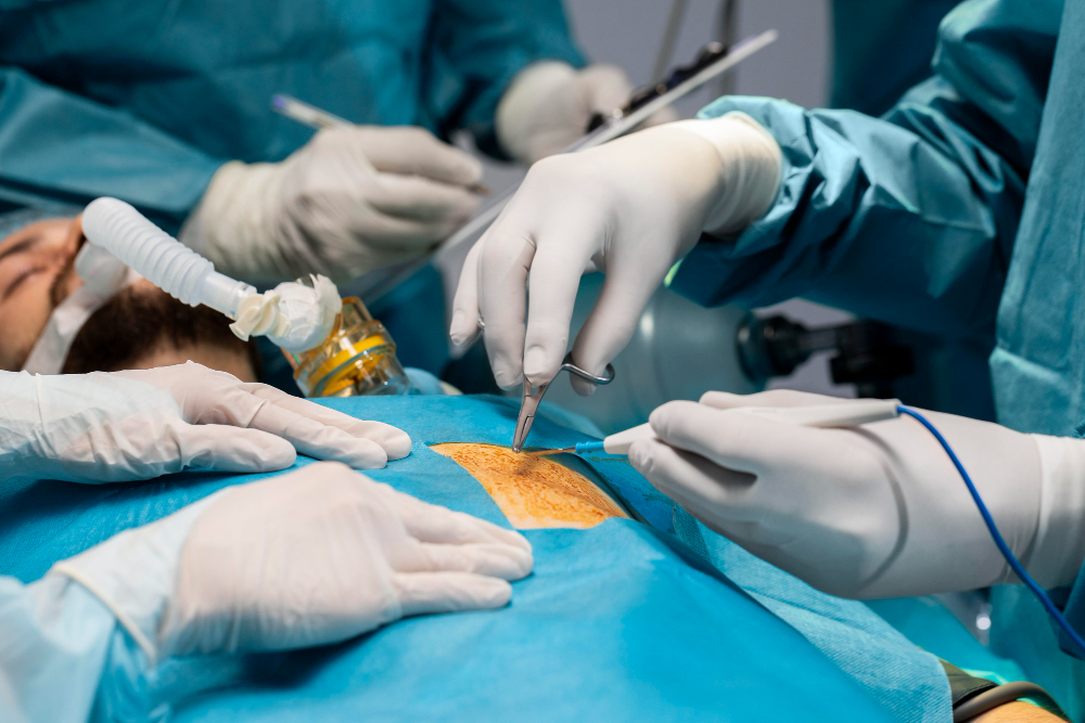 Colorectal Surgery